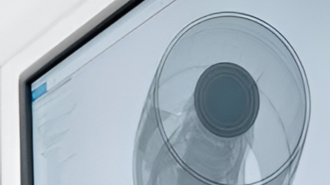 CT Measuring and its Wide Applications Range